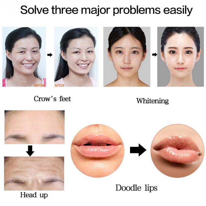 0.3ml Hyaluronのペンの唇の注入口の注入の噴霧器の高圧Hyaluronic酸のペンしわの取り外し- aliexpress.comの$43.20の価格の買物のための針のMesotherapy銃無し|imall.com