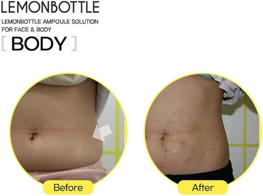 レモンボトル リポラボ リポリシス 体重減少 脂肪減少 レモンボトル